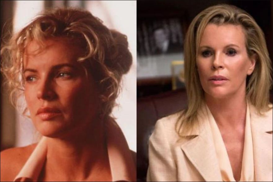 Kim Basinger cirugía plástica