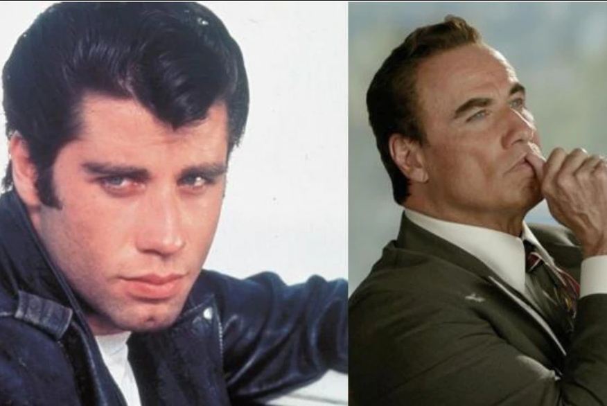 John Travolta cirugía plástica