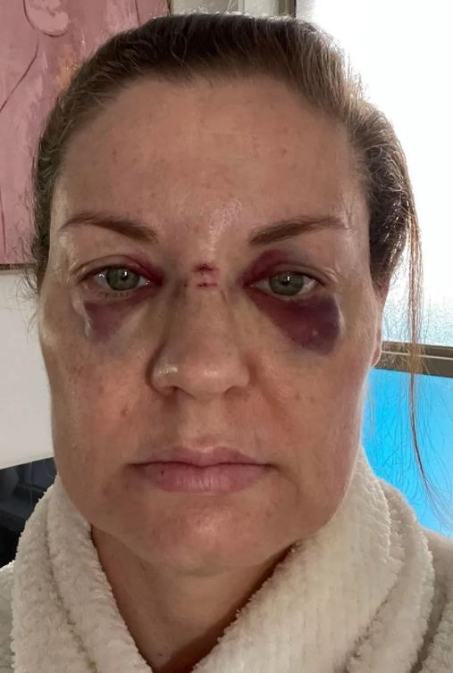 mujer acusó a Axl Rose