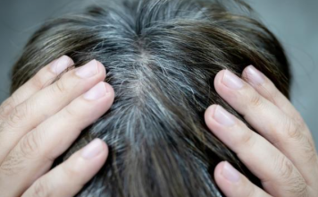 Las canas pueden combatirse con un antioxidante natural