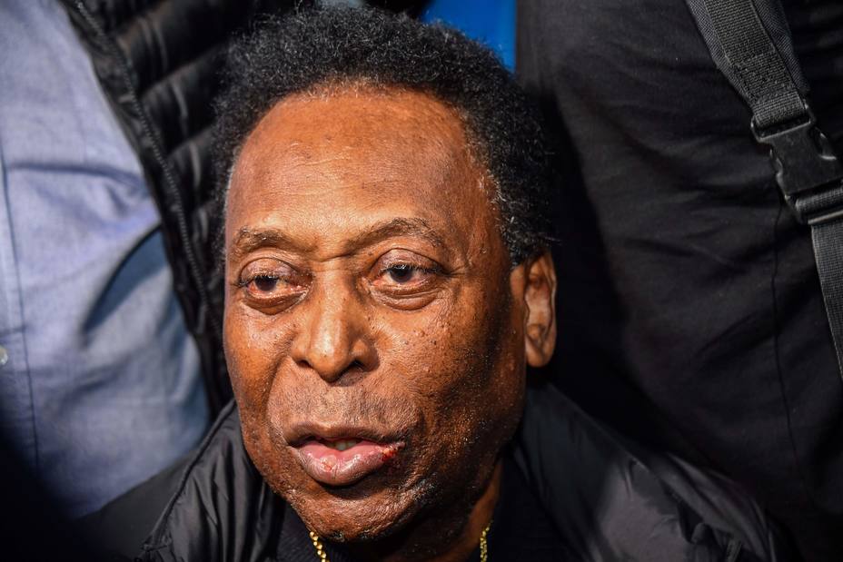 pele-fue-operado-con-exito-calculo-renal_279061.jpg
