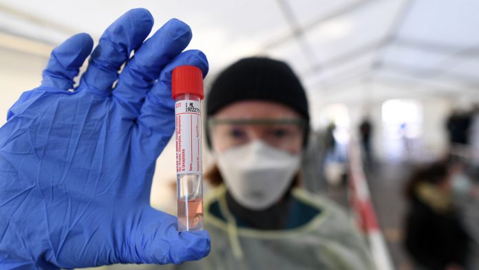 Coronavirus: ¿Por qué los PCR son mejores que los test rápidos?