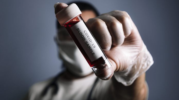 Un estudio reveló que el tipo de sangre influye en el riesgo de padecer covid-19
