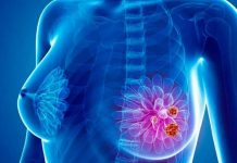Bioanalista busca crear anticuerpo para diagnóstico de cáncer de mama en Mérida