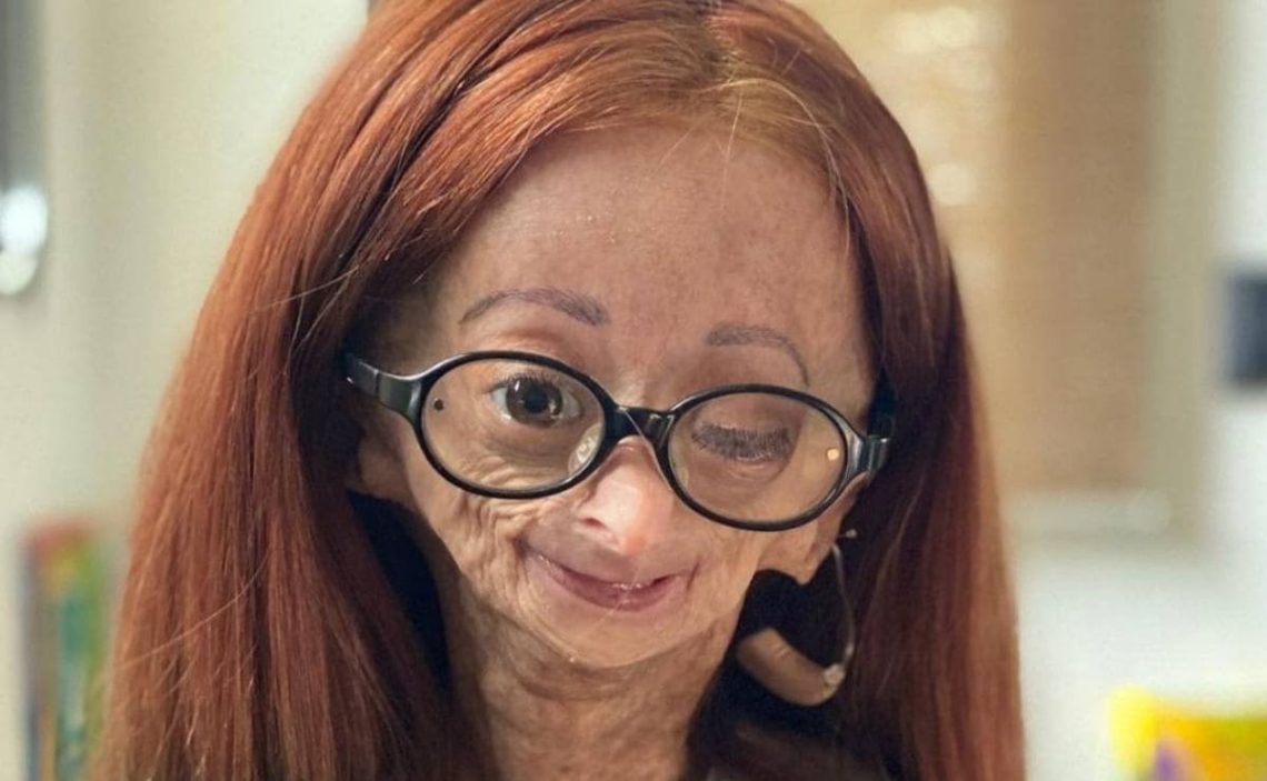 Adalia Rose Williams