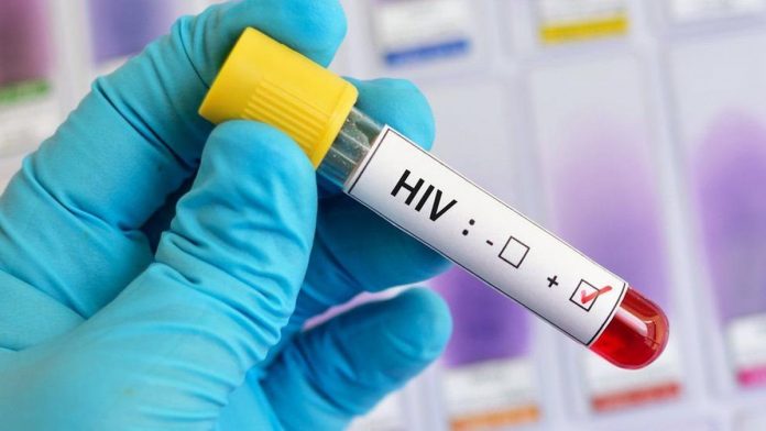 vacuna contra el VIH, El Nacional
