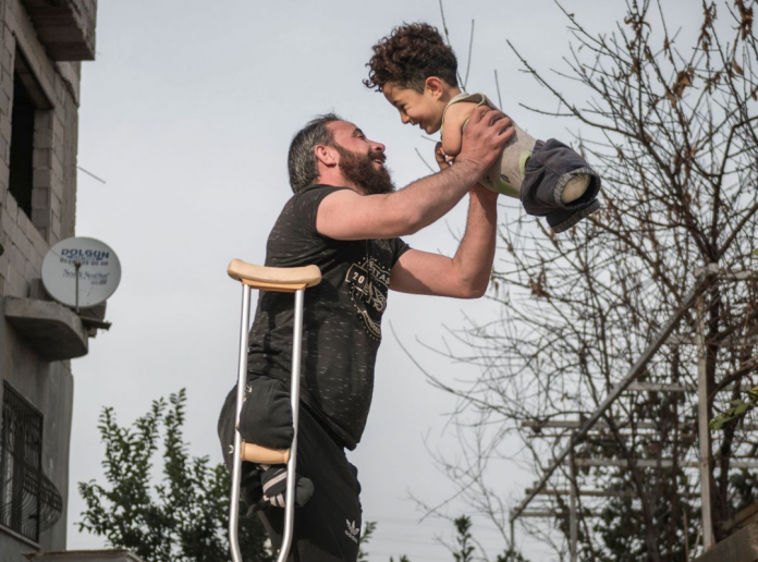 Padre e hijo sirios prótesis