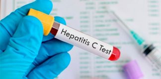 OMS hepatitis aguda