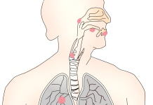 cáncer de garganta, sexo oral