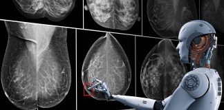 Mamografías IA