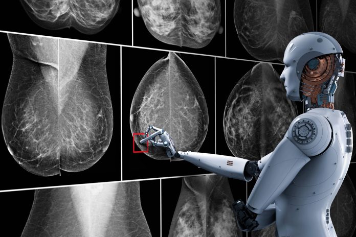 Mamografías IA