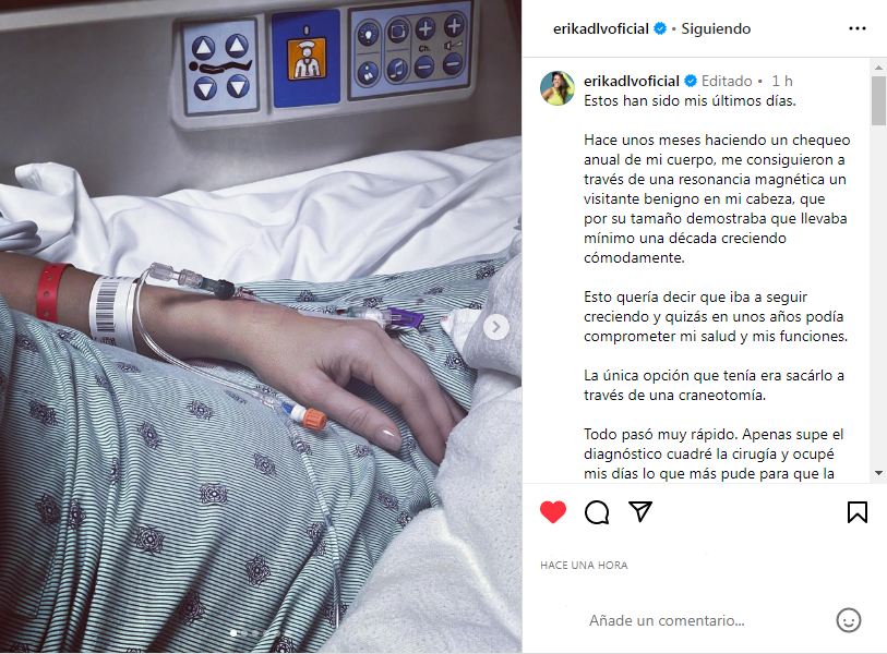 Erika De La Vega se sometió a una craneotomía por tumor benigno