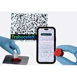 Xenco Medical presenta TrabeculeX Continuum, una innovadora convergencia de salud digital y biomateriales, en el CES 2024 de Las Vegas, la mayor conferencia tecnológica del mundo