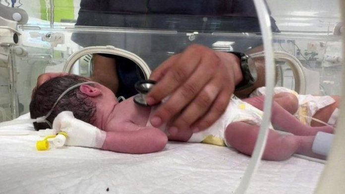 bebé de Gaza
