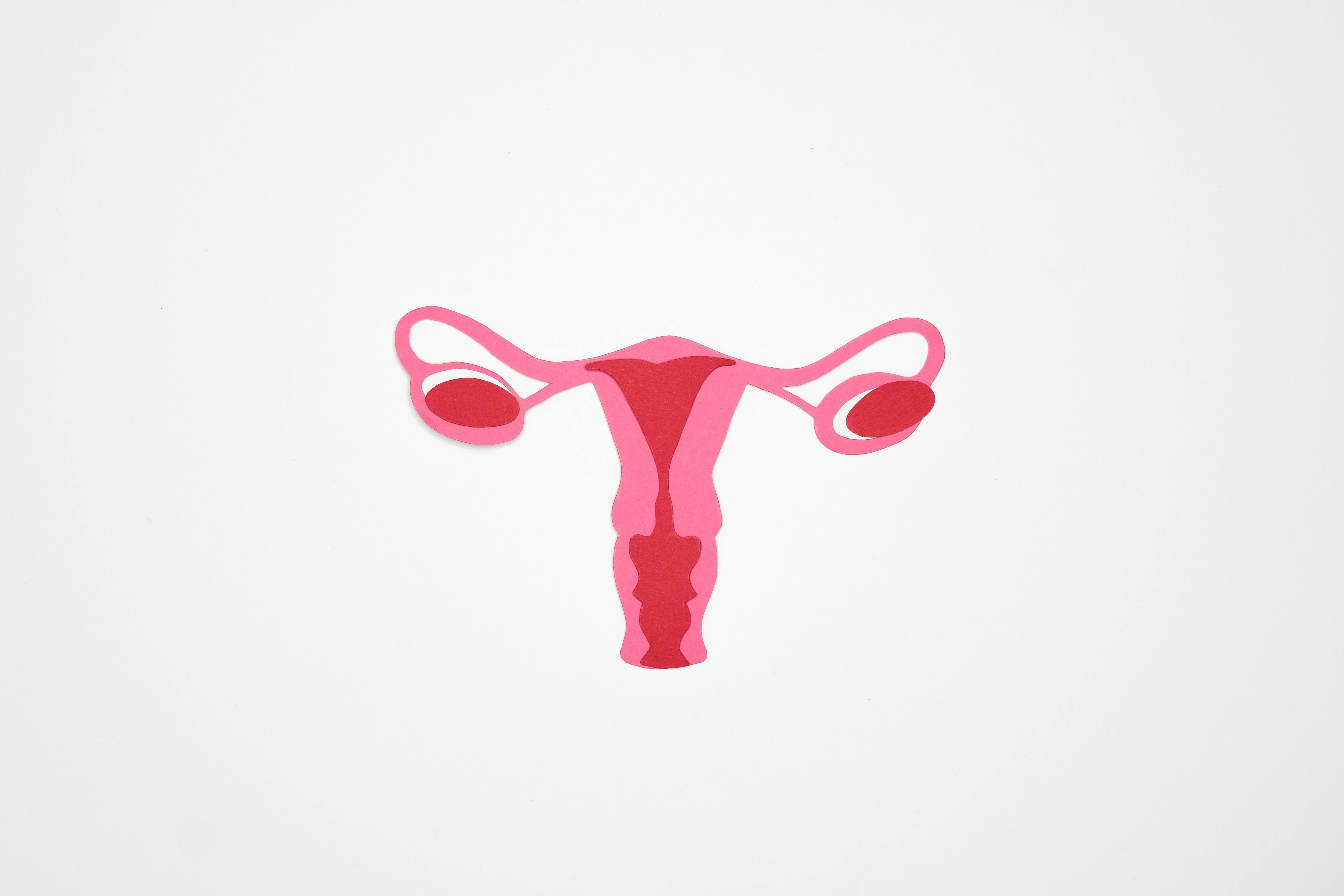 cáncer ovario vagina