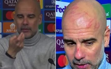 Guardiola ironizó sobre sus arañazos en la cabeza: “Quise hacerme daño”