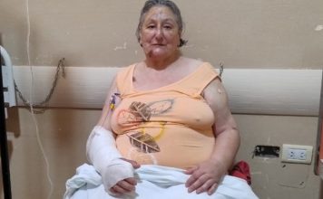 Murió la única superviviente del derrumbe de un hotel en Argentina